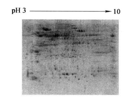 Principle and Protocol of the PRO Q Diamond Staining