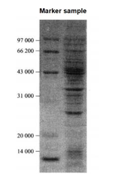 Protocol of the Detection of 32P Radioactive Markers