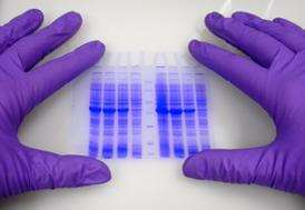 SUMO-tag Protein Production