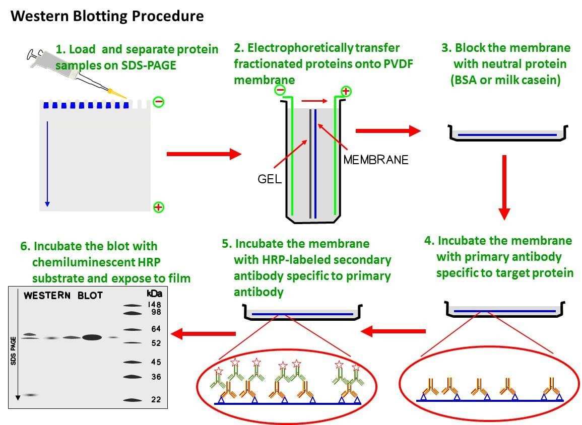 Western blot protocol