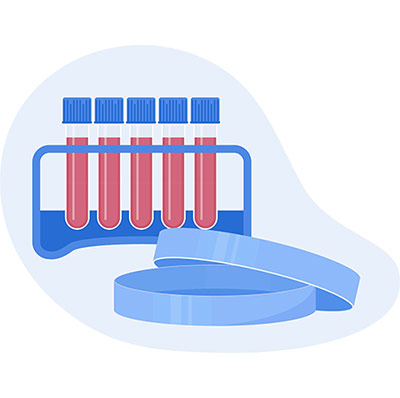 Stable  Cell Line Construction