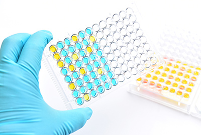 Enzyme activity assay and inhibitor screening service