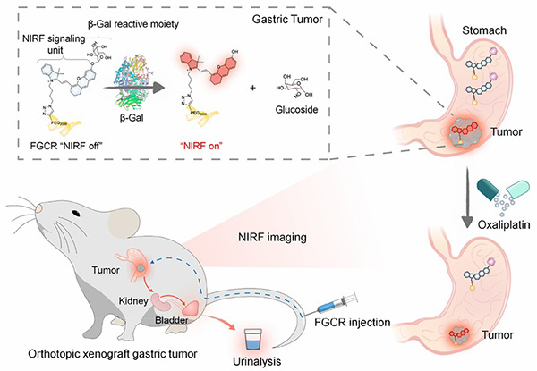Graphic abstract illustrating a &beta;-galactosidase-activated fluorogenic reporter for gastric cancer detection in vivo and in urine