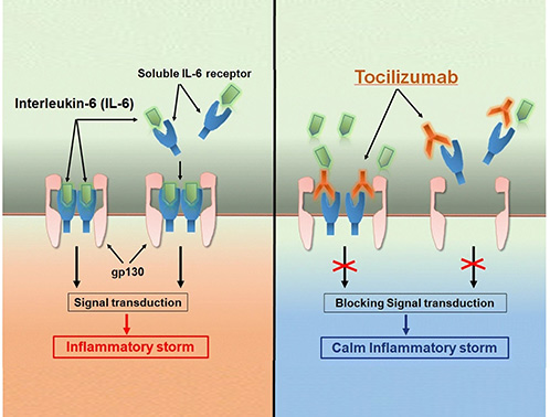 Mechanism of tocilizumab (anti-IL-6R).