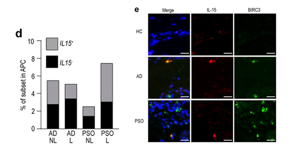 Single-cell analysis of human skin identifies CD14+ type 3 dendritic cells co-producing IL1B and IL23A in psoriasis.