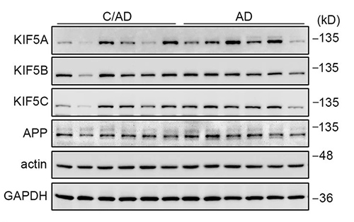 Normal levels of KIF5 but reduced KLC1 levels in both Alzheimer disease and Alzheimer disease in Down syndrome: evidence suggesting defects in anterograde transport.