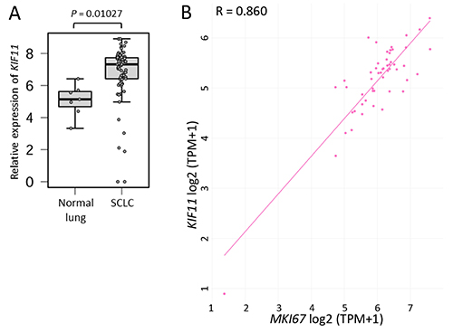 Small cell lung carcinoma cells depend on KIF11 for survival.