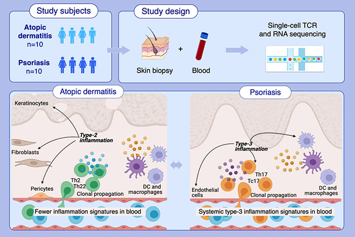 Single-cell profiling of immune response in atopic dermatitis vs. psoriasis