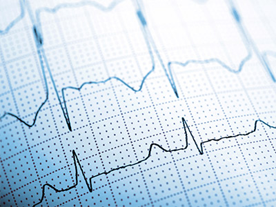 Cardiac safety assay.