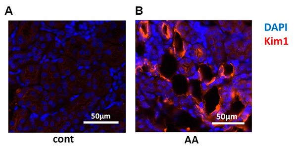 Visualization of renal pathology in a multiple low-dose aristolochic acid (AA) model using Saa3 promoter-Luc mice.