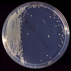 Enterobactersakazakii