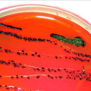 Coliformbacteria