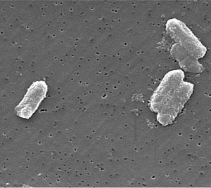 Enterobacteriaceaefamily