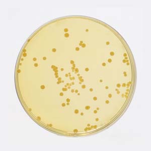 Flat-sourspores