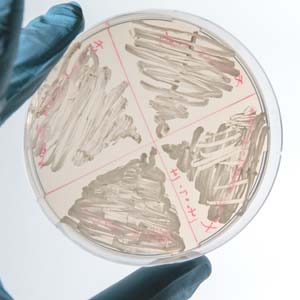 Enumerationofyeast