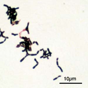 Bifidobacterium
