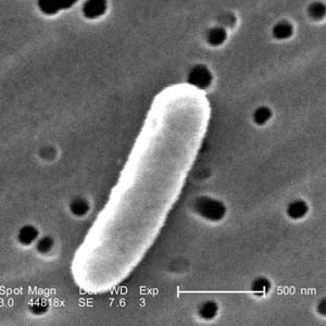 DiarrheogenicE.coli