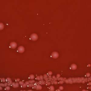 Shigella