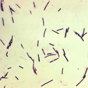 Clostridiumperfringens