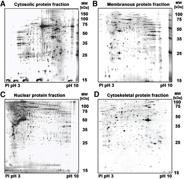 Protein fractions were isolated to achieve reproducible fractionation of cytosolic, membrane/organelle, nuclear and cytoskeletal proteins
