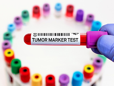 Techniques and methods for protein quantitation