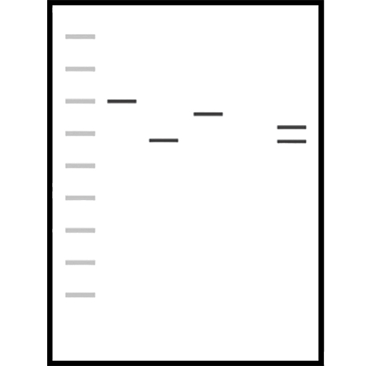 Western blot detection and analysis
