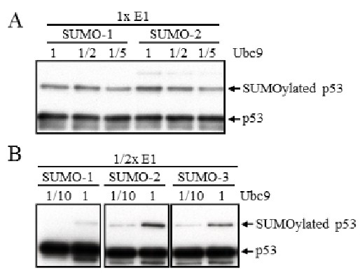 In vitro SUMOylation assay to study SUMO E3 ligase activity