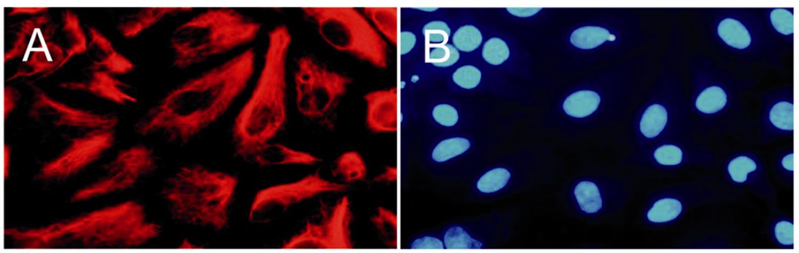 Expression of mesodermal markers