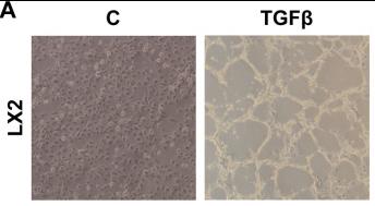 Fig1. Obesogenic phenotype of bmp8a-/- zebrafish.