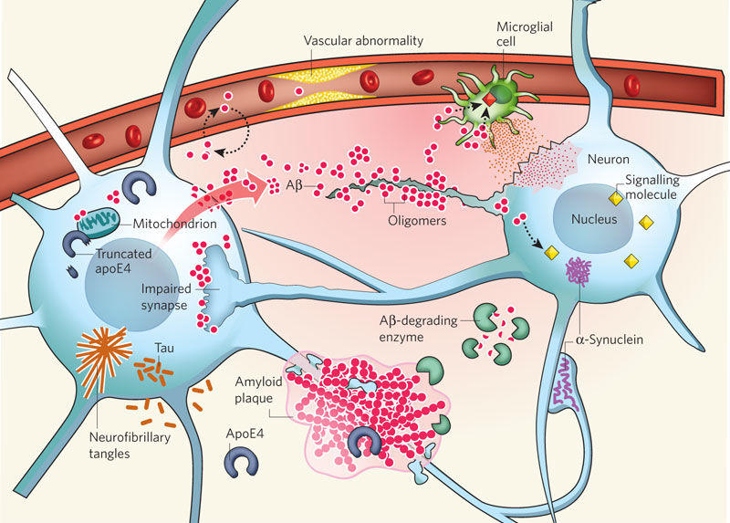 Alzheimer‘s disease: pathophysiology (Some key players in the pathogenesis of AD).