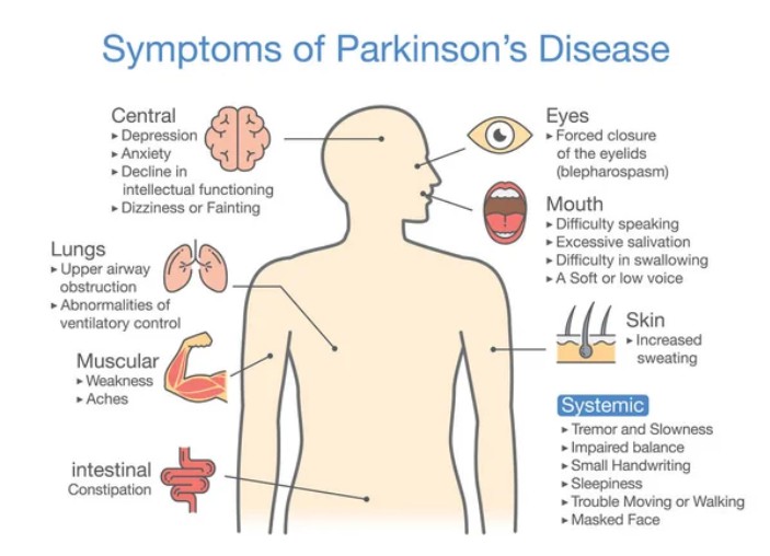 Symptoms of Parkinson's Disease - Creative BioMart