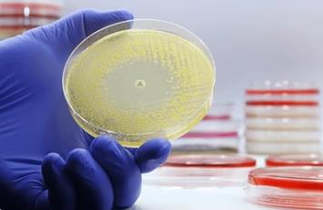 What are Bacterial Infections