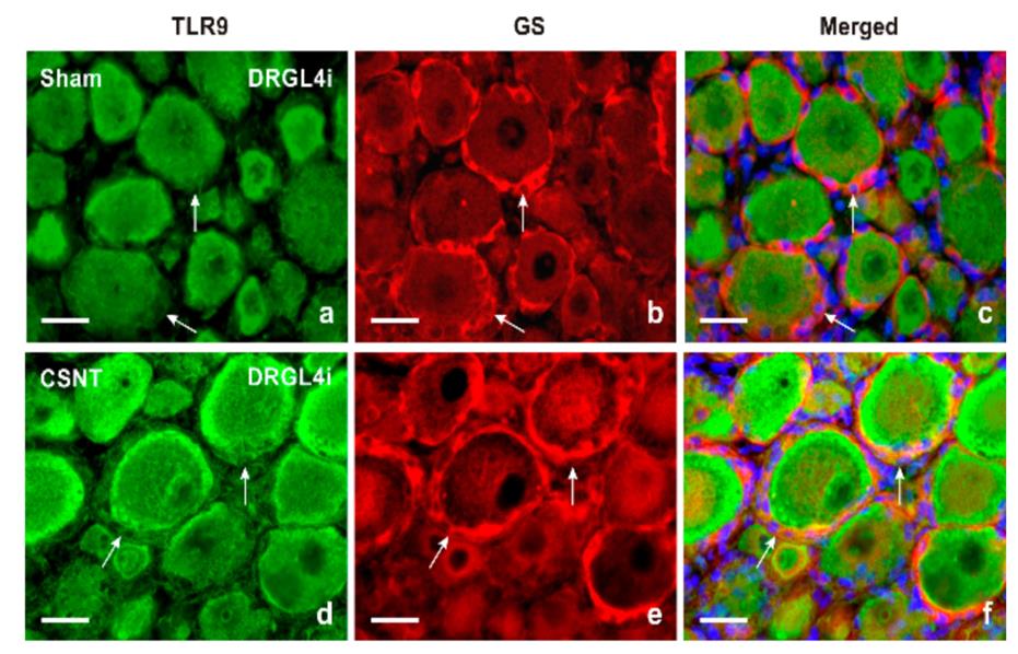 Fig1. Double immunofluorescence staining for TLR9 and GS as a marker of satellite glial cells (SGCs).