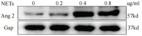 Fig2. Western blot analysis of ANGPT2 expression after HUVECs were stimulated by different concentrations of NETs.