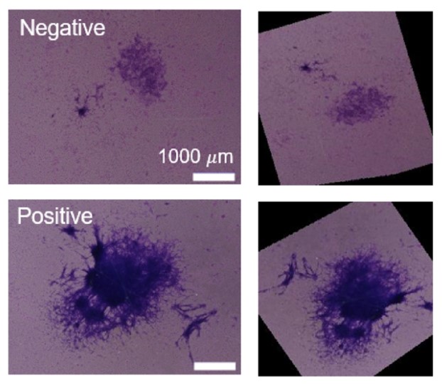 Fig3. Representative images of transformed foci induced by exposure to TPA.