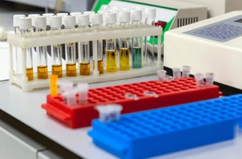 Types of Chromatography