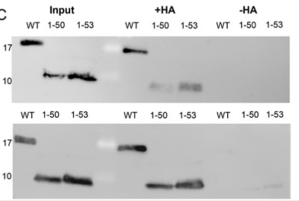 Fig3. S-acylation: M2 wt and the mutants were expressed in 293 T cells.