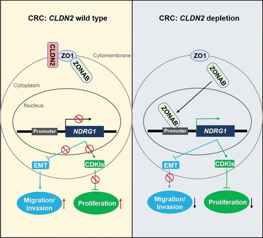 CLDN2 promotes colorectal cancer growth