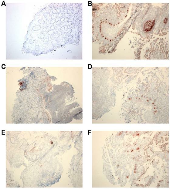 Immunohistochemical detection of DEFA5 protein in intestinal mucosa.