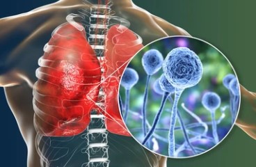 Fungal infections