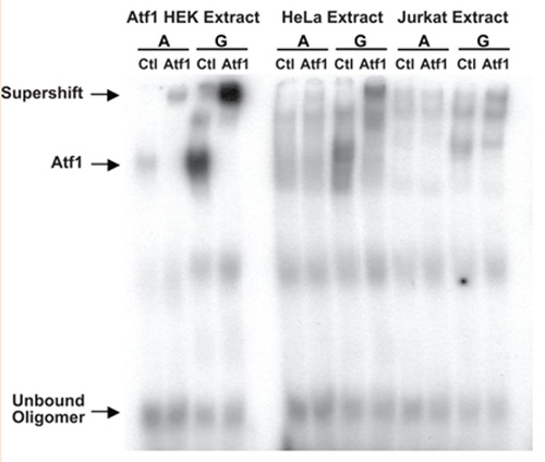 Fig2. An electrophoretic mobility shift assay (EMSA) was performed with 32P-labelled oligonucleotides containing the
        core binding sequence for ATF1 containing the A or G variant of rs2027820.