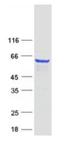 AFM results
