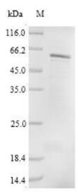 AFM results