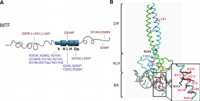 MITF mutations found in melanoma