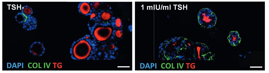 Active Native Bovine TSH Protein