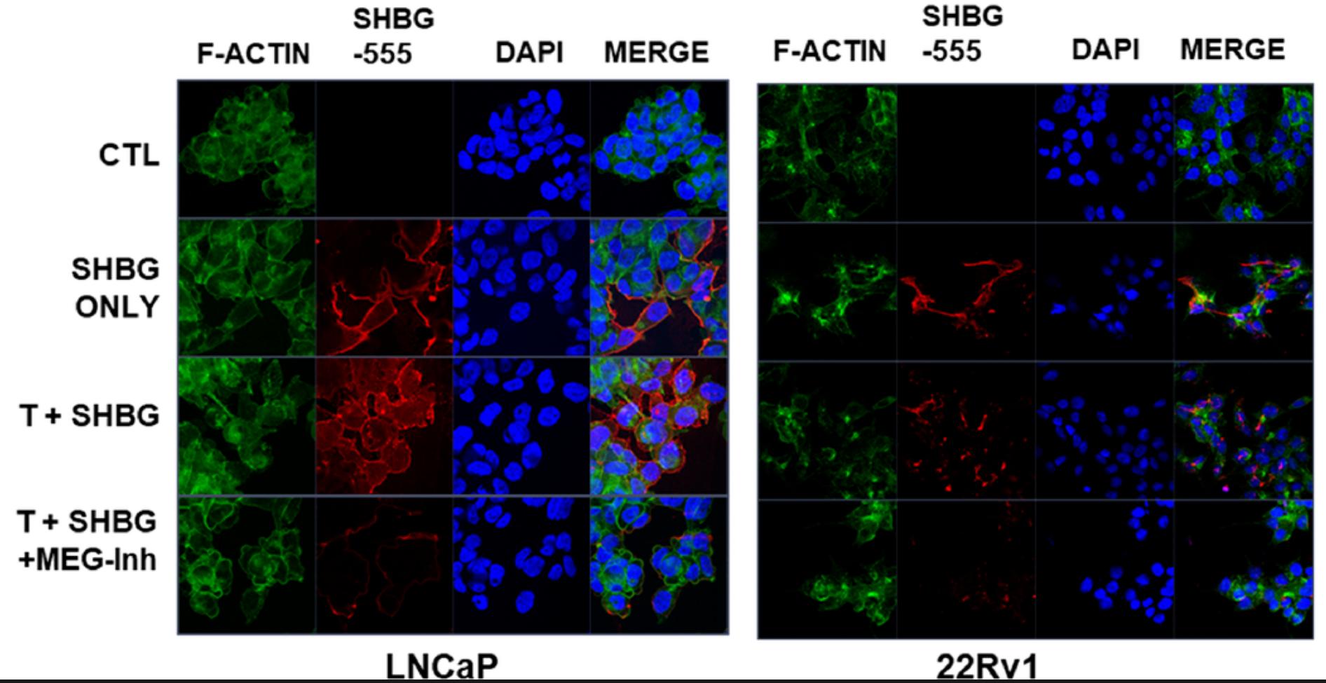 Native Human Serum Sex Hormone Binding Globulin