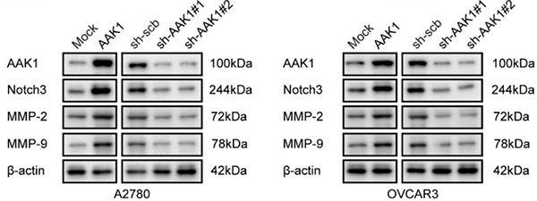 Fig1. Western blotting showing the protein levels of AAK1, Notch3, MMP-2, and MMP-9 in A2780 and OVCAR3 cells stably
        transfected as indicated, respectively.
