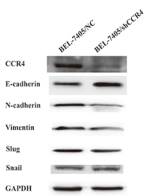 Fig2. CCR4 induces Epithelial-mesenchymal transition (EMT) in HCC cells