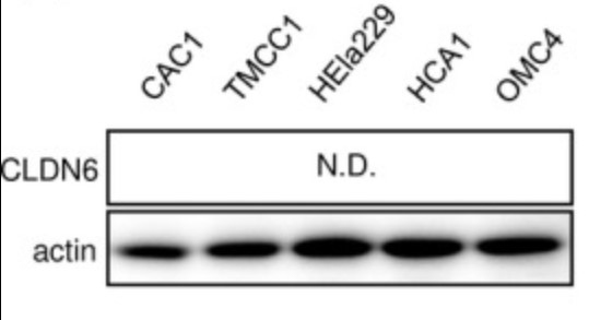 Fig4. Overexpression of claudin‐6 (CLDN6) promotes the malignant transformation of cervical adenocarcinoma
        (ADC) cells