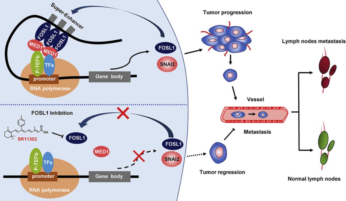 Figure 1. FOSL1 promotes metastasis of head and neck squamous cell carcinoma. (Zhang M, et al., 2021)